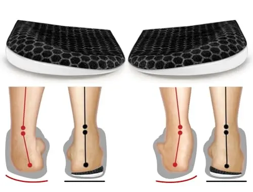 BIGGCOOL corrective insoles with lateral heel wedge for supination