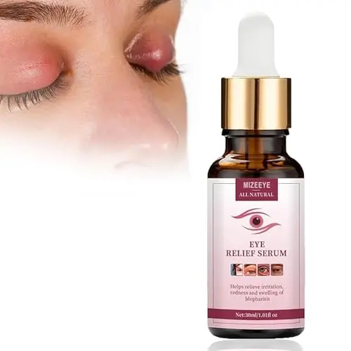 MIZEEYE Chalazion Eye Treatment serum for blepharitis and puffiness
