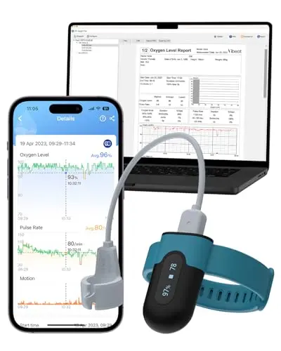 Vibeat OxyU wrist pulse oximeter with Bluetooth and real-time alerts